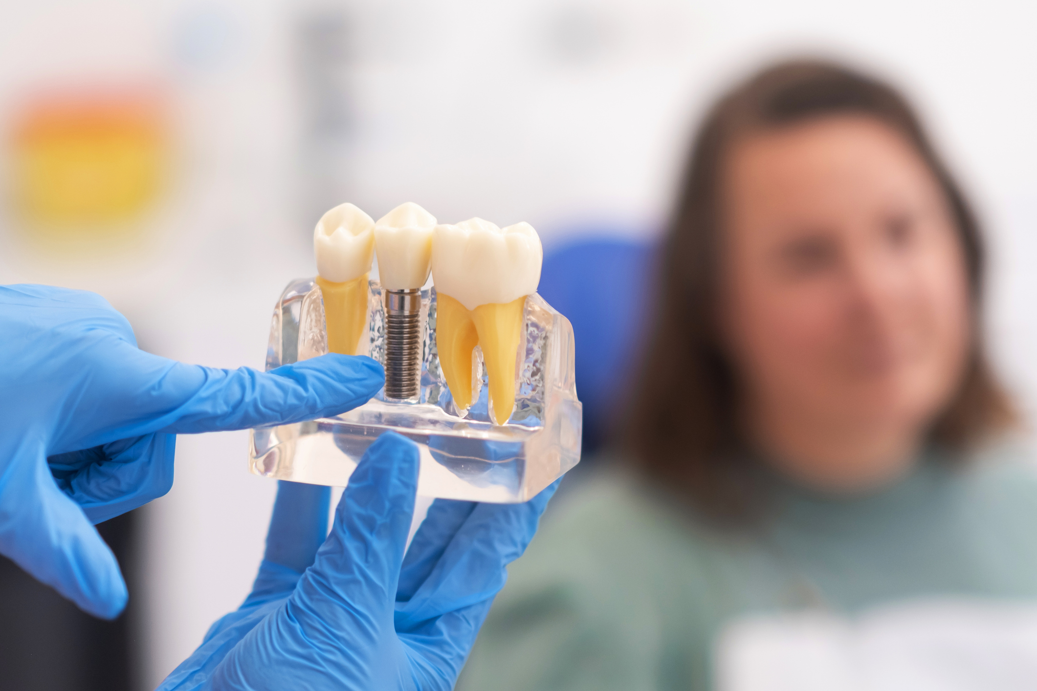 Todos pueden ponerse implantes dentales